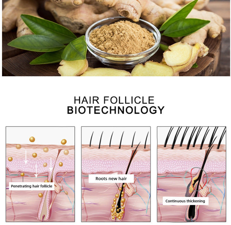 GZBITYHN, Hair Growth Oil Hair Growth Oil Oem Hair Care Essential Oil.