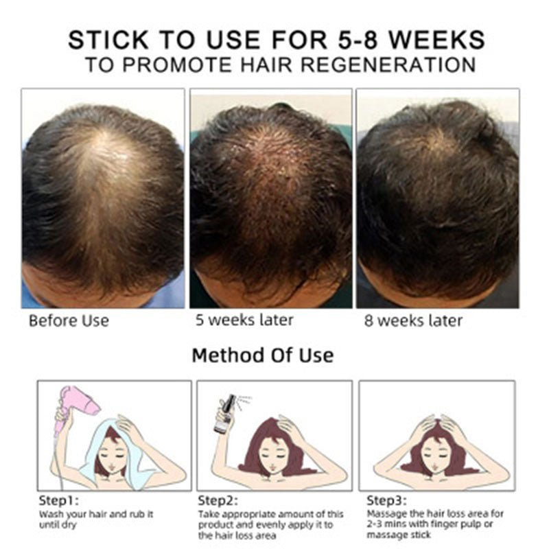 GZBITYHN, Hair Growth Oil Hair Growth Oil Oem Hair Care Essential Oil.
