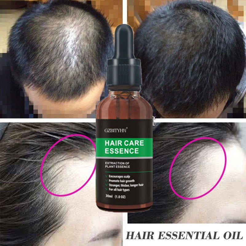 GZBITYHN, Hair Growth Oil Hair Growth Oil Oem Hair Care Essential Oil.