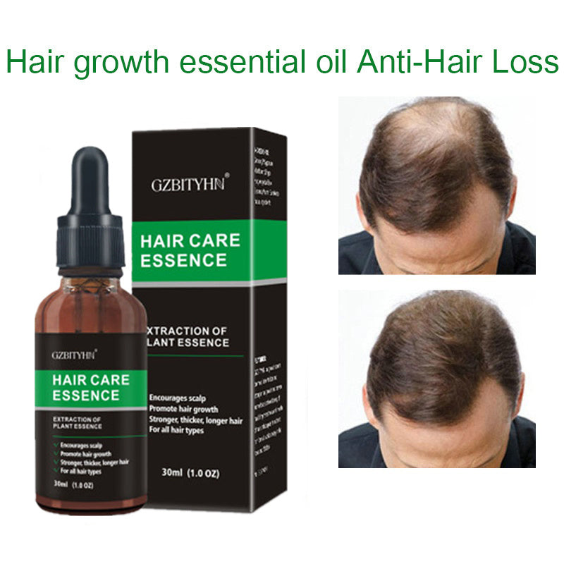 GZBITYHN, Hair Growth Oil Hair Growth Oil Oem Hair Care Essential Oil.