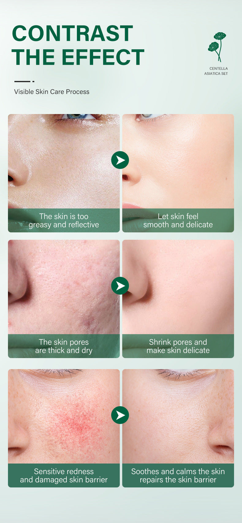 Centella Snow Grass Set Combination Facial