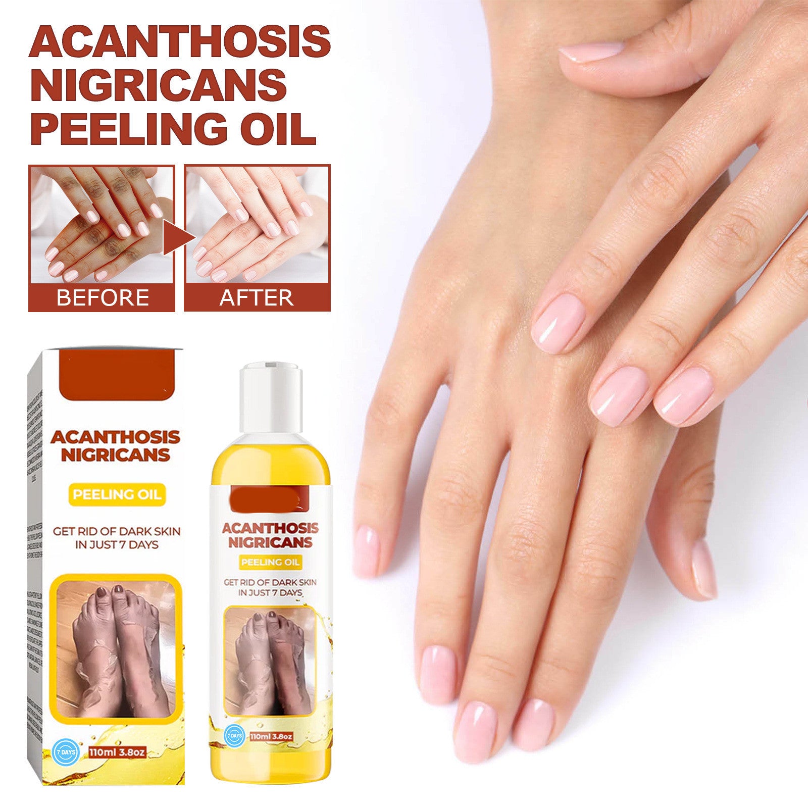 Acanthosis nigricans Cleansing Moisturizing And Skincare Oil
