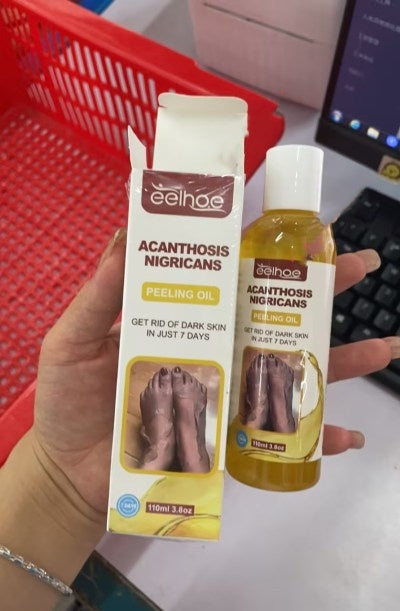 Acanthosis nigricans Cleansing Moisturizing And Skincare Oil
